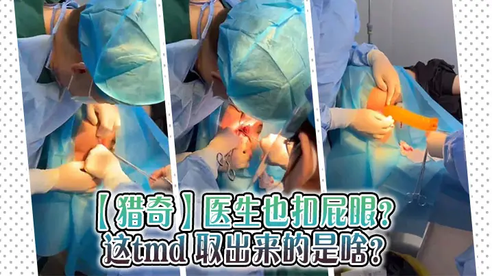 【猎奇】医生也扣屁眼？ 这tmd 取出来的是啥？